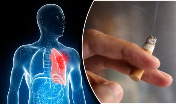 ফুসফুসে ক্যান্সার - Lung Cancer