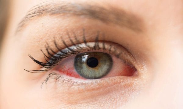 ধূমপান চোখের সমস্যা সৃষ্টি করে - Smoking Causes Eye Problems