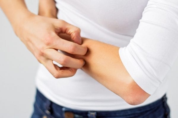 জ্বালা এবং ফুসকুড়ি কম করতে নিমপাতার গুণাগুণ