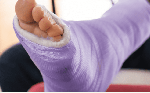 হাড় ভাঙ্গার চিকিৎসা 