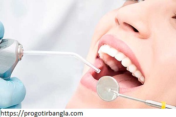 ক্যাভিটি কি?