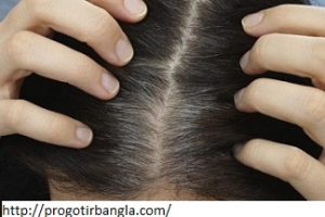 পাকা চুল কি