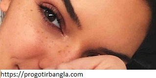 ত্বকের কালো দাগ রিমুভ করতেঃ