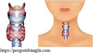 থাইরয়েড প্রতিকার করার উপায়
