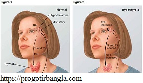 থাইরয়েডর লক্ষণ