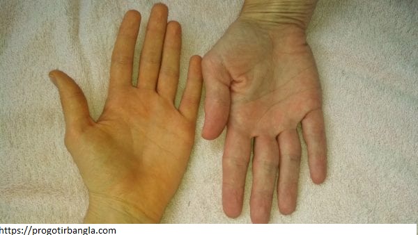 হাতের তালু (Palm) 