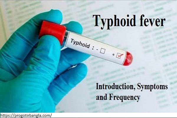 টাইফয়েড