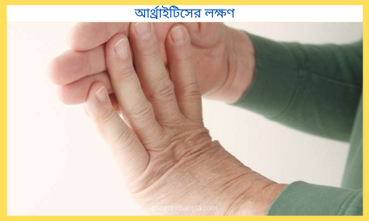 আর্থ্রাইটিস লক্ষণ