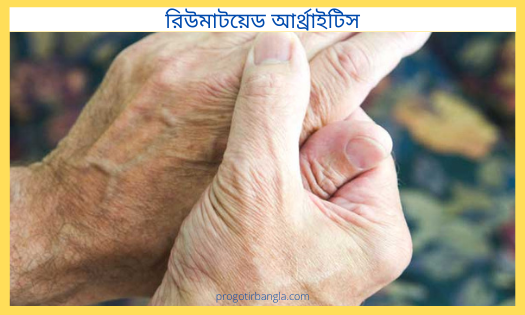 রিউমাটয়েড আর্থ্রাইটিস