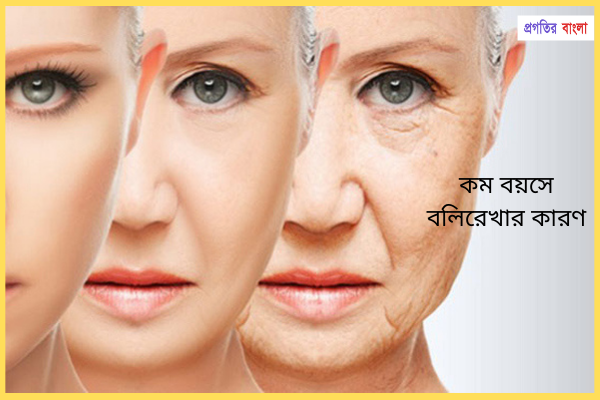 বলিরেখার কারণ