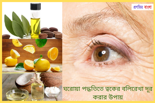 ঘরোয়া পদ্ধতিতে ত্বকের বলিরেখা দূর করার উপায়