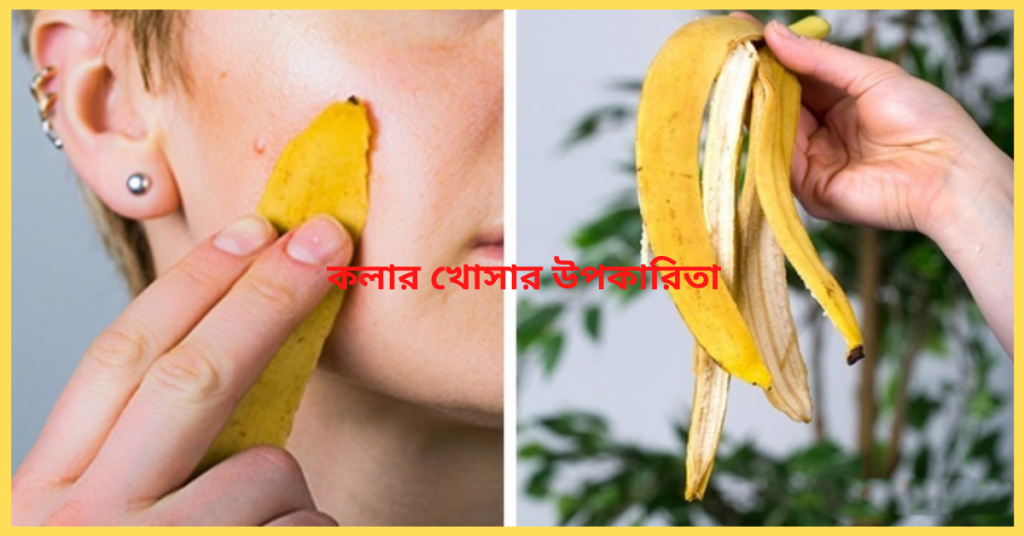 কলার খোসা