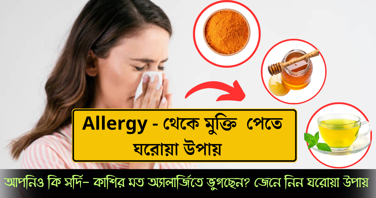 অ্যালার্জি