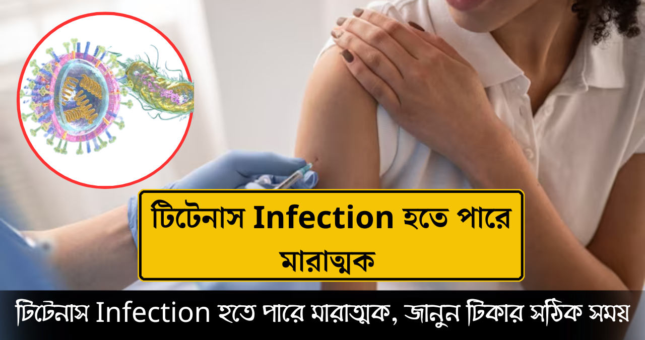 টিটেনাস 