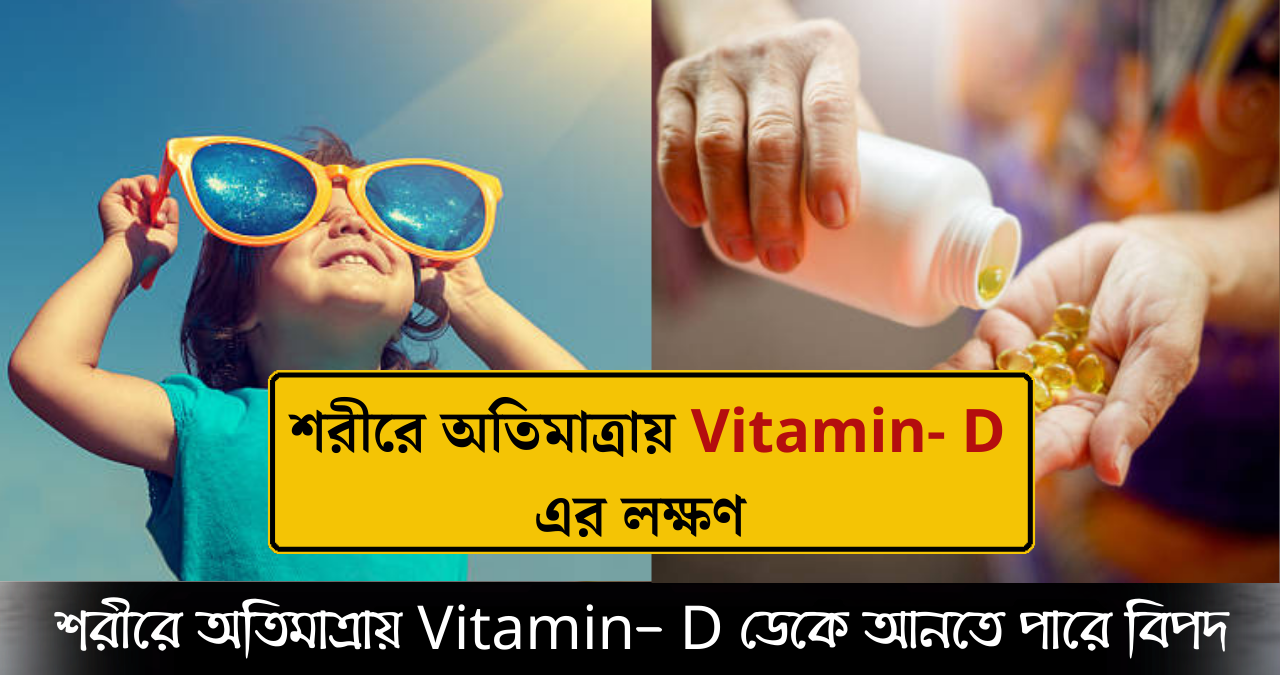 Vitamin- D 
